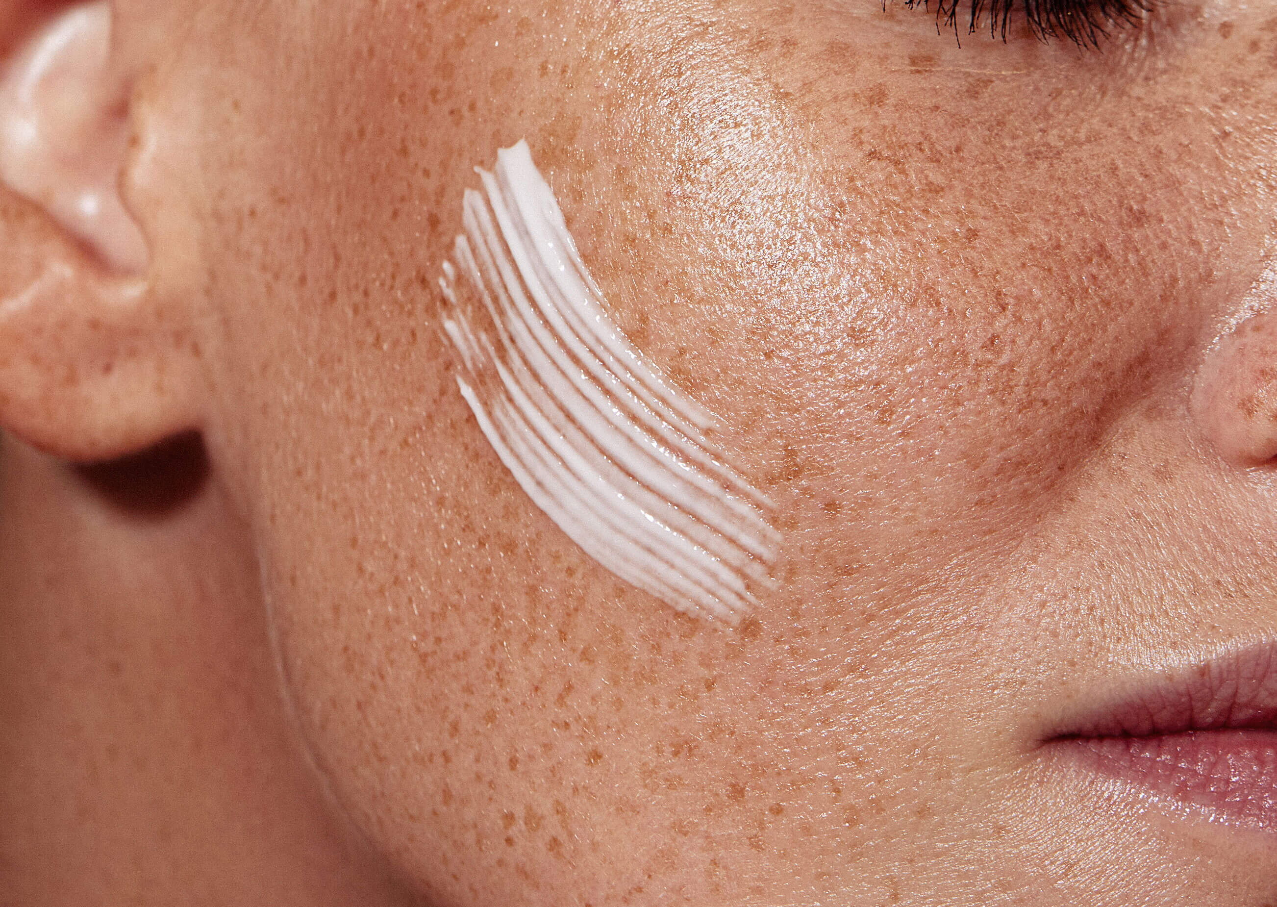 A close-up photograph of a person's cheek showing freckles and a smear of white skincare cream applied to the skin.
