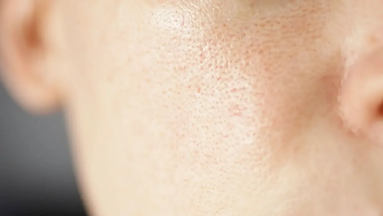 A close-up photograph showing the texture of human skin with visible, enlarged pores on the cheek area near the nose.