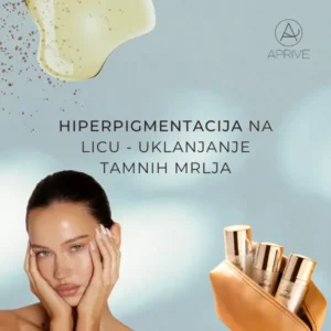 hiperpigmentacija-lica-fleke