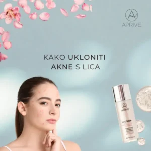 kako-ukloniti-akne-na-licu-thumbnail