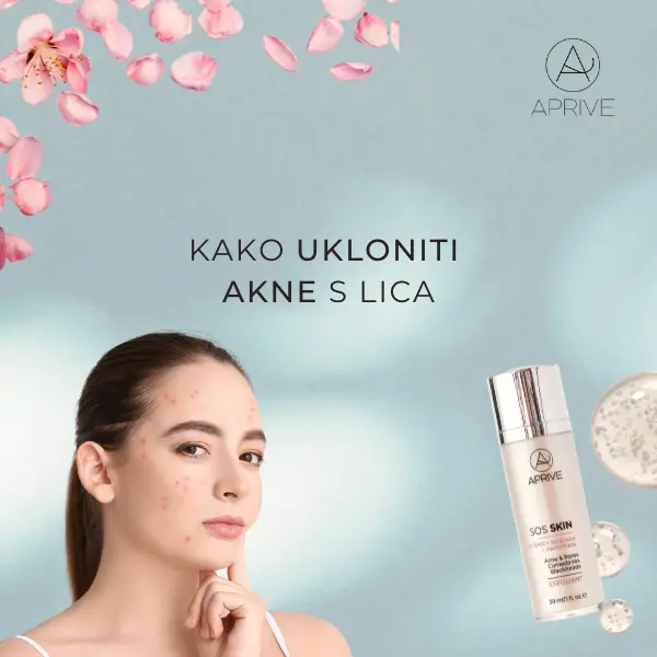 kako-ukloniti-akne-na-licu-thumbnail